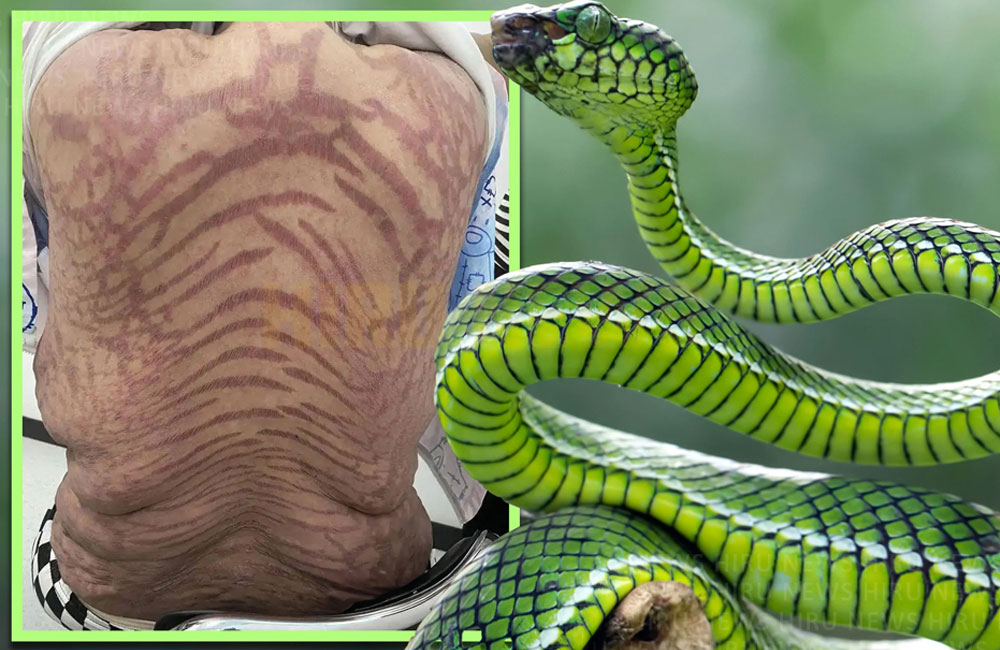 ඉන්ටර්නෙට් එකෙන් හමුවූ ක්‍රීම් එකක් ගෑ කතගේ ඇඟ පුරාම පොළොං-වයිරං ඇවිත්