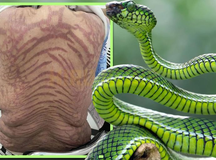 ඉන්ටර්නෙට් එකෙන් හමුවූ ක්‍රීම් එකක් ගෑ කතගේ ඇඟ පුරාම පොළොං-වයිරං ඇවිත්