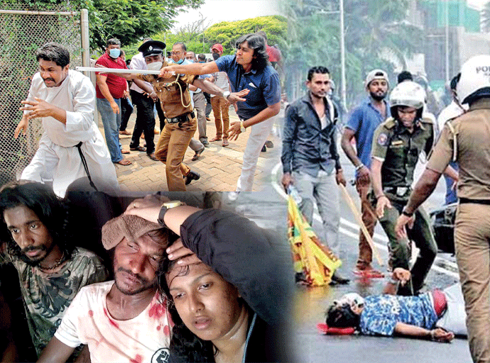 තුවාල ලත් අරගලකරුවන් 39දෙනකු ගේ වාර්තා අධිකරණයට