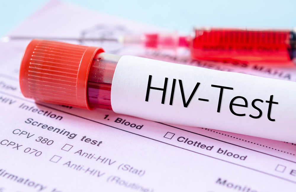 HIV ආසාදිතයන් 14%කින් ඉහළට