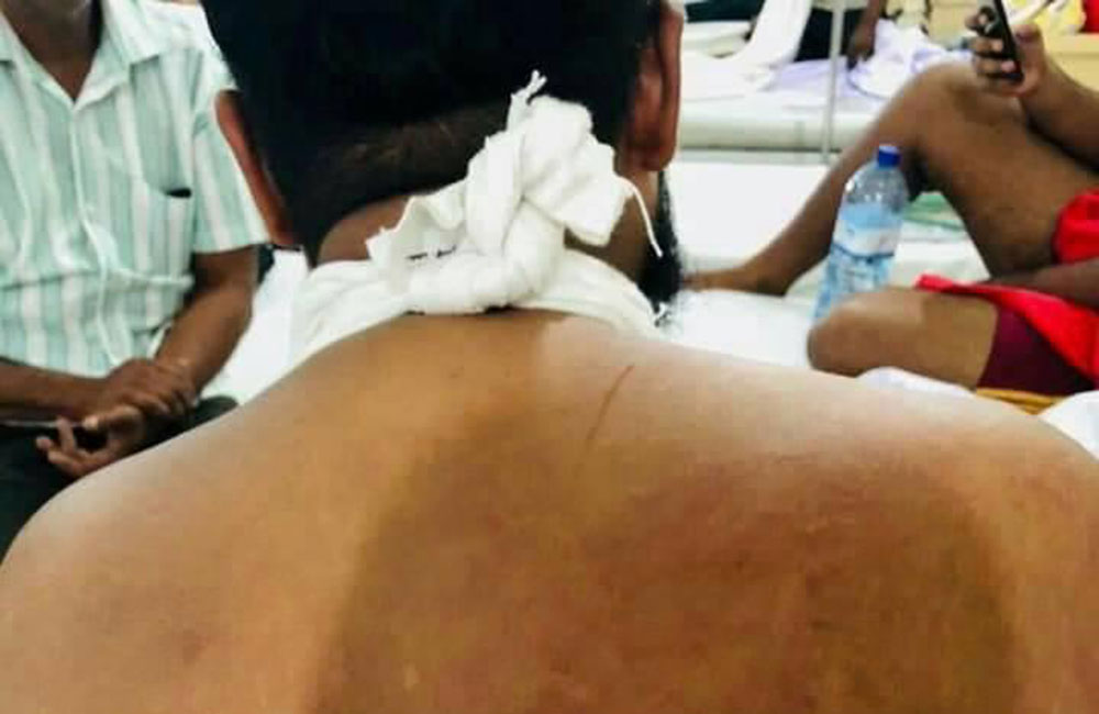 නවක වදයට එරෙහිවූ සිසුන් දෙදෙනෙකුට අමානුෂික ප්‍රහාරයක් !