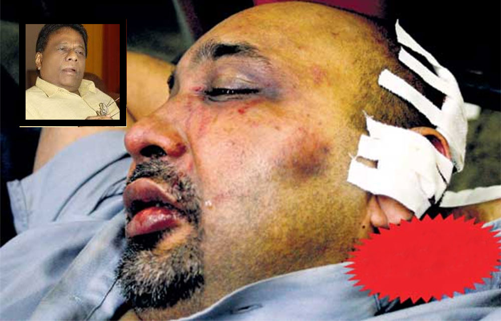 කීත් නොයාර් පැහැරගැනීම ගැන ඩලස් ගේ අනාවරණය මෙන්න 