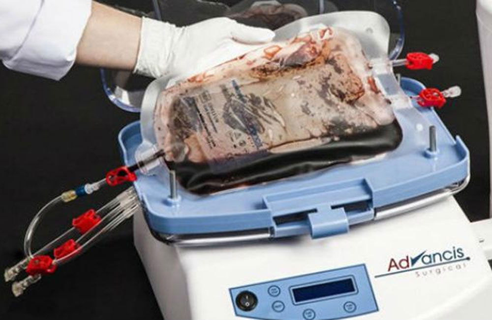 ඇමති රාජිතගෙන් : වකුගඩු රෝගීන්ට කාන්දුපෙරණ යන්ත්‍ර නිවසටම !