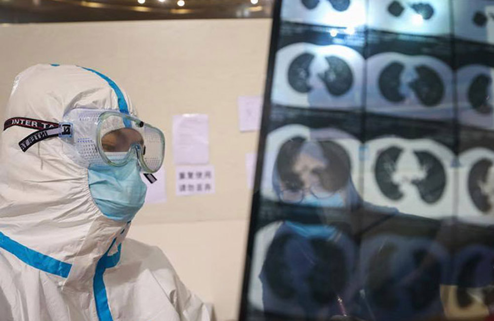 කොවිඩ් 19 මිනිසුන් නසන හැටි මෙන්න !