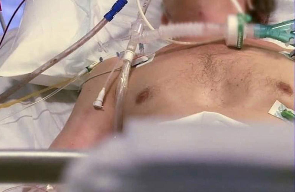 ලංකාවේ කොවිඩ් මරණ 07 යි : ආසාදිතයන් 188 යි !