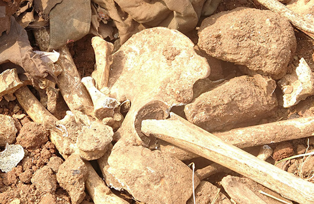 මුලතිව් මාන්කුලම් රෝහල් බිමේ අස්ථි කොටස් මතුවේ : සමූහ මිනීවලක් දැයි සැකයක් !