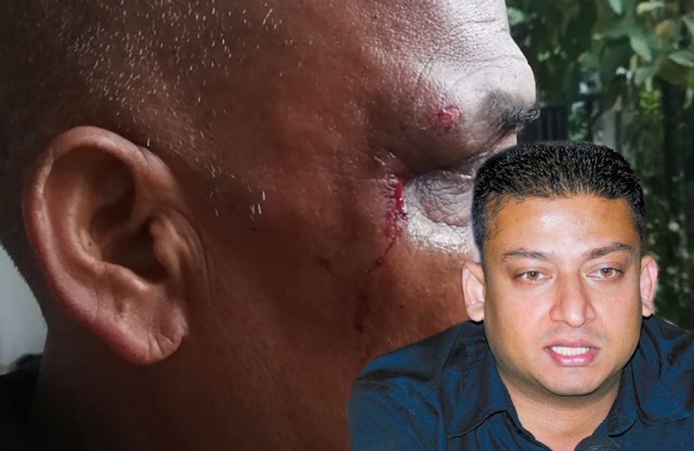 දිලුම් අමුණුගමගේ කල මැර ප්‍රහාරයට පොහොට්ටුවෙන් ම විරෝධයක් !