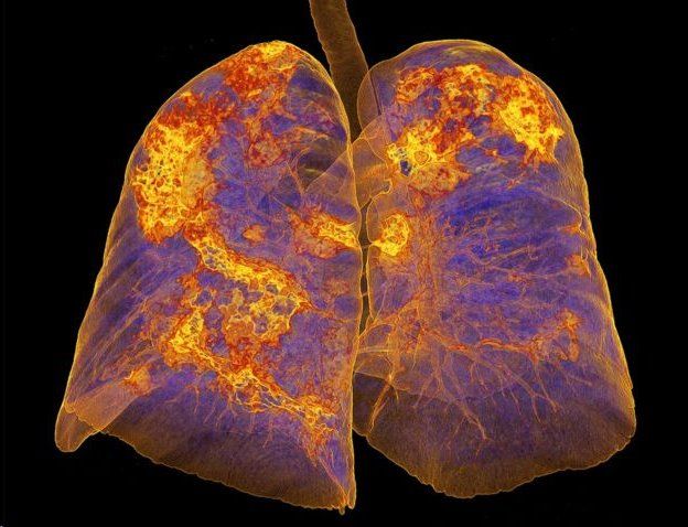 111324629 e87ed117 9ada 477a bcc6 9112ebc8d416