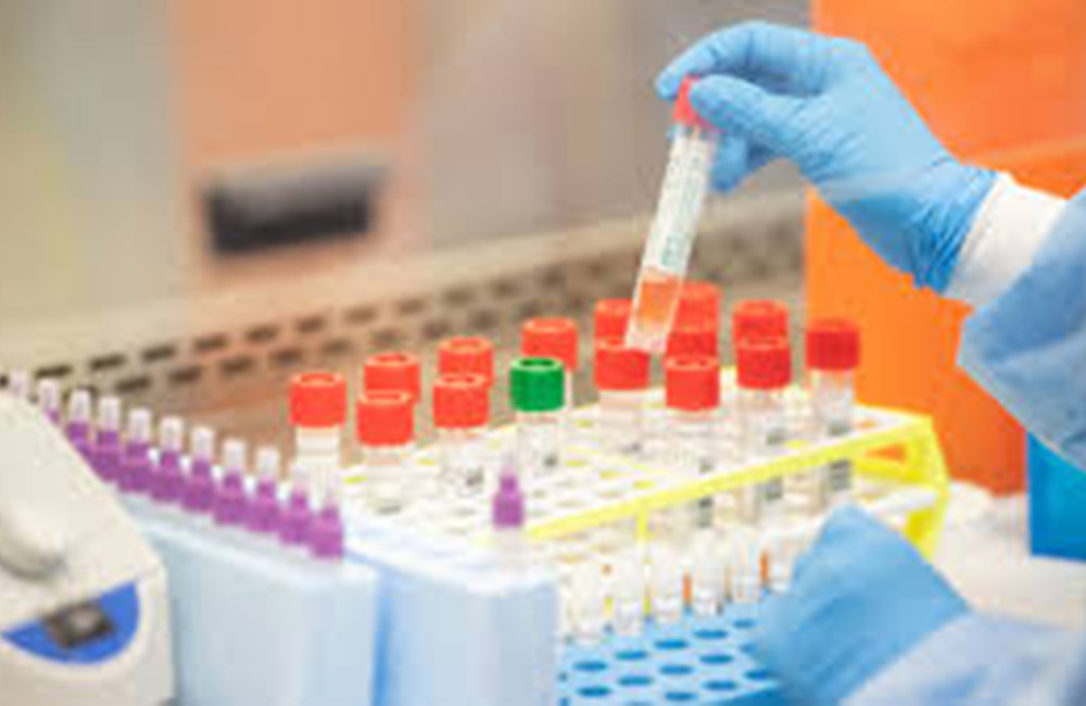 RT-PCR  සාවද්‍ය වාර්තා කඩාකප්පල්කාරී වැඩක් : ජනාධිපතිට පැමිණිල්ලක් !