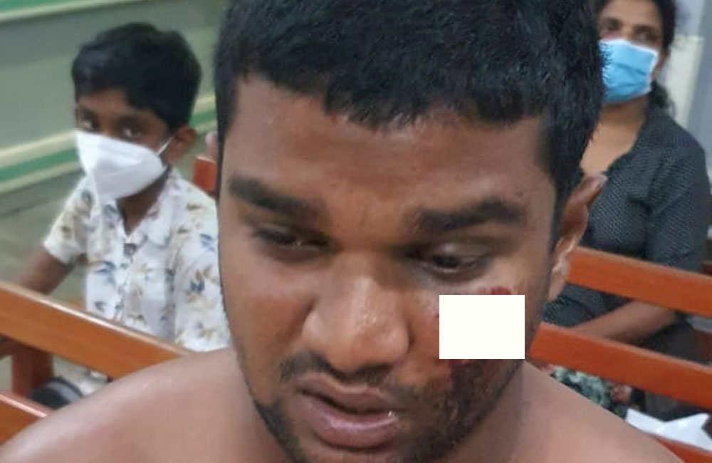 මිගාරට එල්ල කළ මිලේච්ඡ පොලිස්  ප්‍රහාරය : අධිකරණයේදී ලැබුණු තීන්දුව !