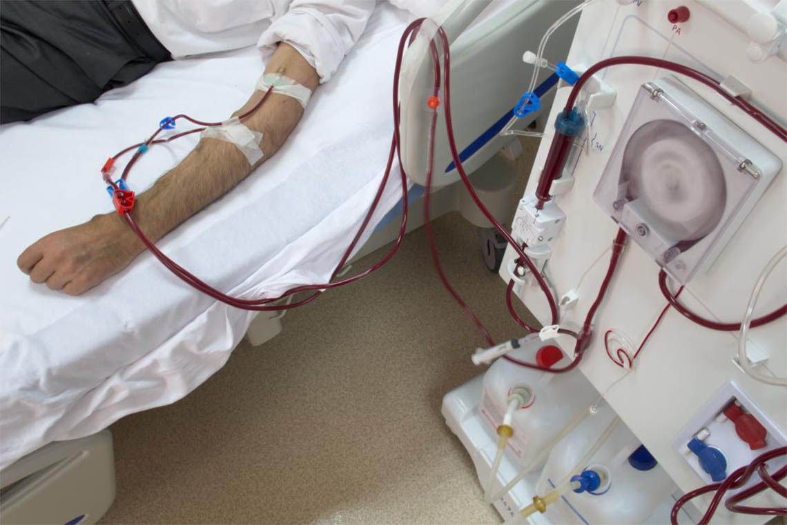 dialysis machine which can help to treat acute renal failure